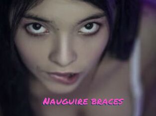 Nauguire_braces